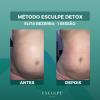 Esculpe Detox massagem Terapêutica desintoxicaca, desinflama e esculpe