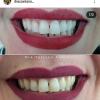 Drª Tatiana Caetano Dentista  Ortodontista  Odontopediatra  Prótese Dentária