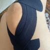 Kinesio tape