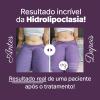 Lipo Sem Corte